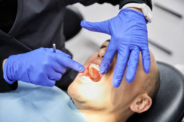 Best Emergency Root Canal Treatment in Sauk Vlage, IL