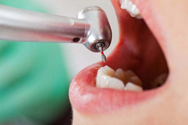 Best Mobile Emergency Dentist in Sauk Vlage, IL